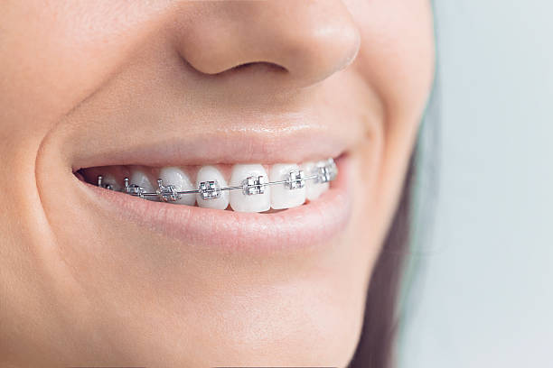 Best Traditional Braces  in Loveland, CO